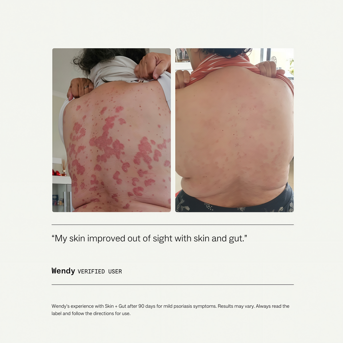 My Way Up Skin + Gut