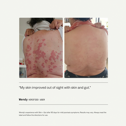My Way Up Skin + Gut