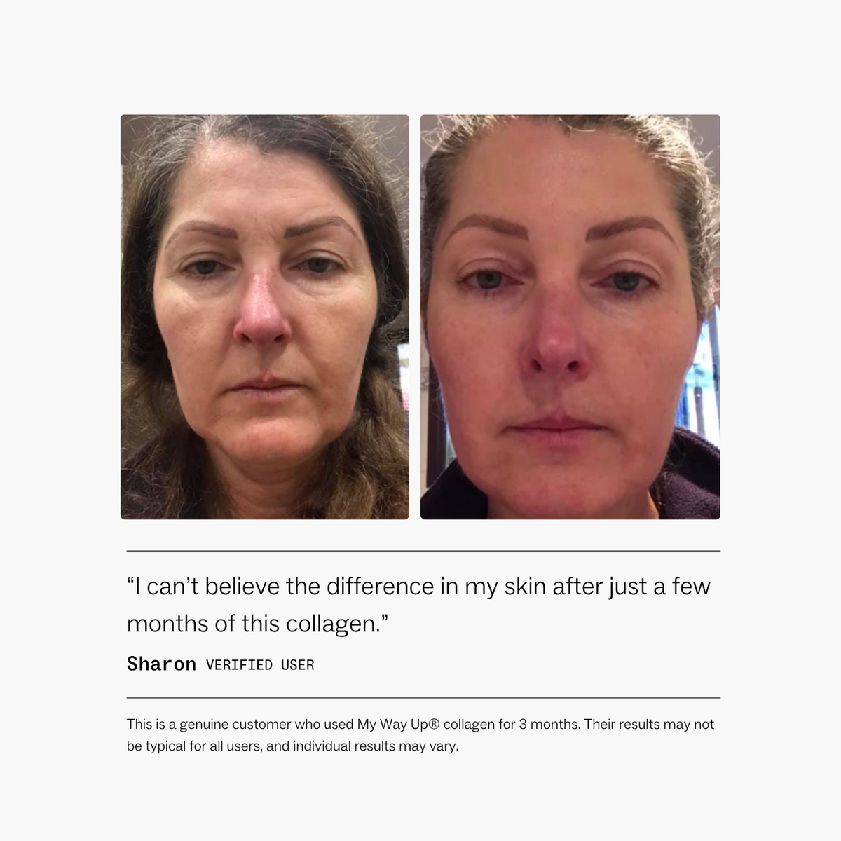 My Way Up Collagen Restore