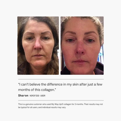 My Way Up Collagen Restore